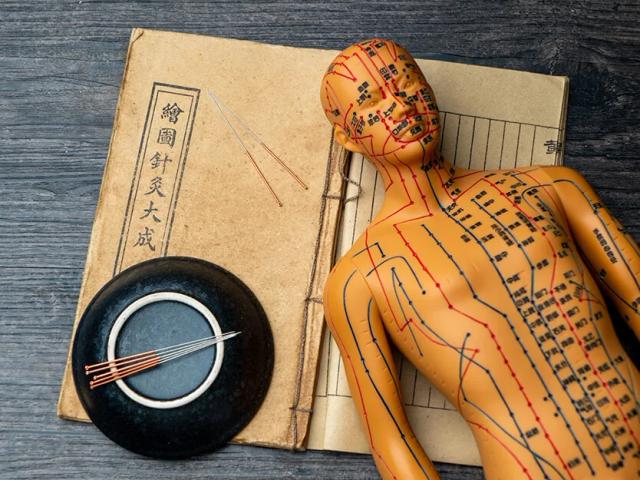 Acupuntura Tradicional