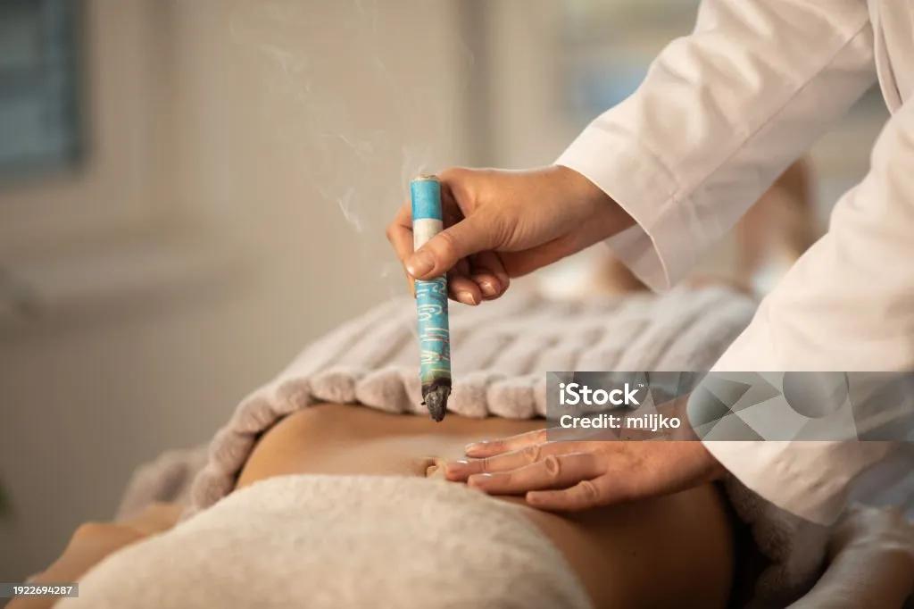 Moxibustion 6