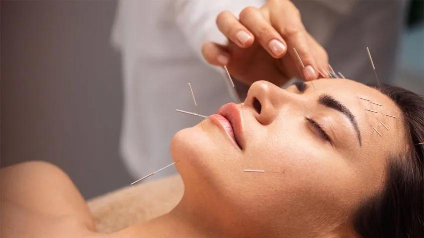 Parálisis Facial 3